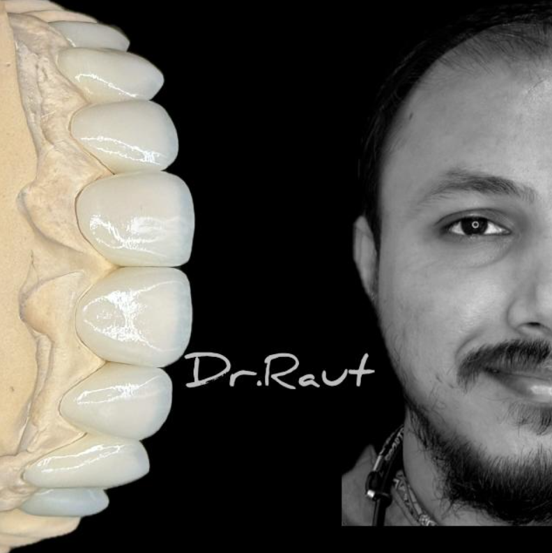 Dr. Raut — Digital Smile Simulation Protocol instructor